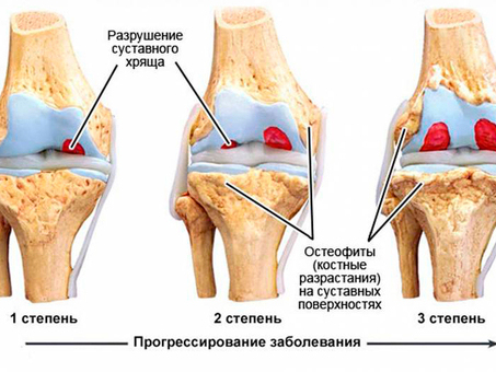 Толщина рельс (Ширина головы рельса ) - Форум ModelldepO