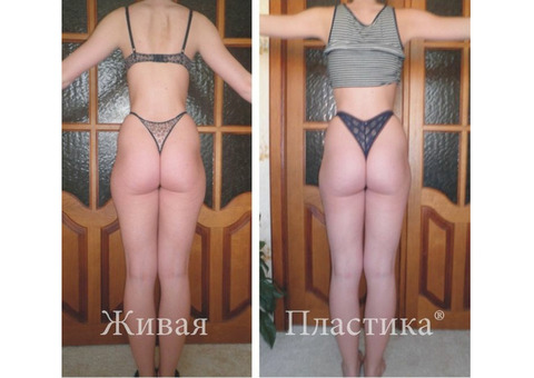 Ручная ЛипоэнергоПластика - Ручная липокоррекция фигуры женщин без лишнего веса