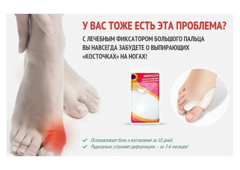 Фиксатор Valgus Pro (фиксатор против выпирающих косточек на ногах)